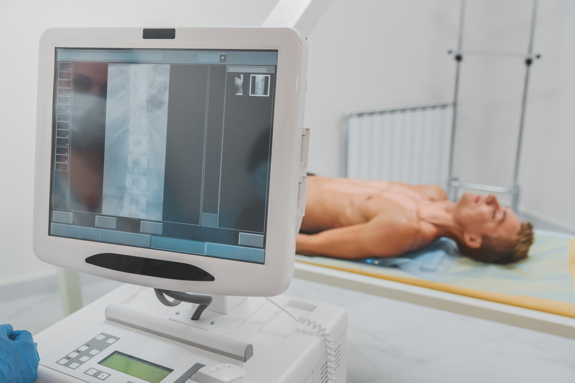 Doctor taking X-ray of patient lying on gurney