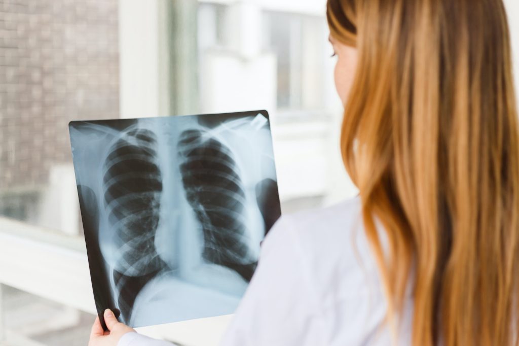 The doctor examines the x-ray image of the chest.